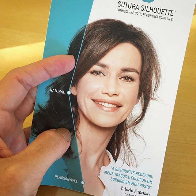 Hoje já foram alguns por aqui.. Sucesso absoluto!#suturasilhouette devolvendo o contorno facial..