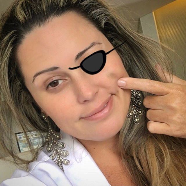 Ossos do ofício! Quanto mais picadas, maior chance de sair #roxa 🤦🏼‍♀️🥊 #nocaute #masvaleapena #diadebeaute #renewmed #casadeferreiroespetodeferromesmo