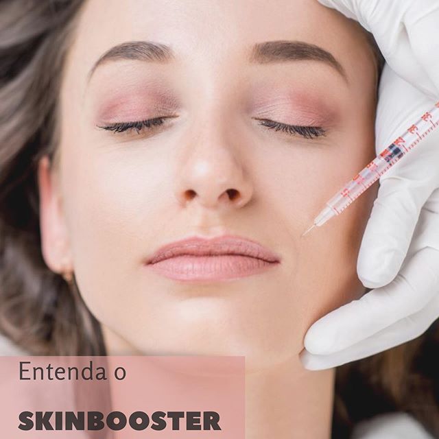 Skinbooster - para uma pele hidratada e cheia de viço!Esse é mais um dos tratamentos a base de ácido hialurônico, para deixar sua pele ainda mais bonita.Parecido com os ácidos de efeito preenchedor, e já com anestésico na composição, o skinbooster serve para rejuvenescer face, colo, mãos, e reduzir pequenas linhas e marcas na pele. Inclusive as de acne! Ele é aplicado ligeiramente mais superficial e não modifica a estrutura do rosto, pois não causa tanto volume como os preenchedores tradicionais.Não deixe de experimentar mais essa maravilha!Excelente pedida mesmo no verão!