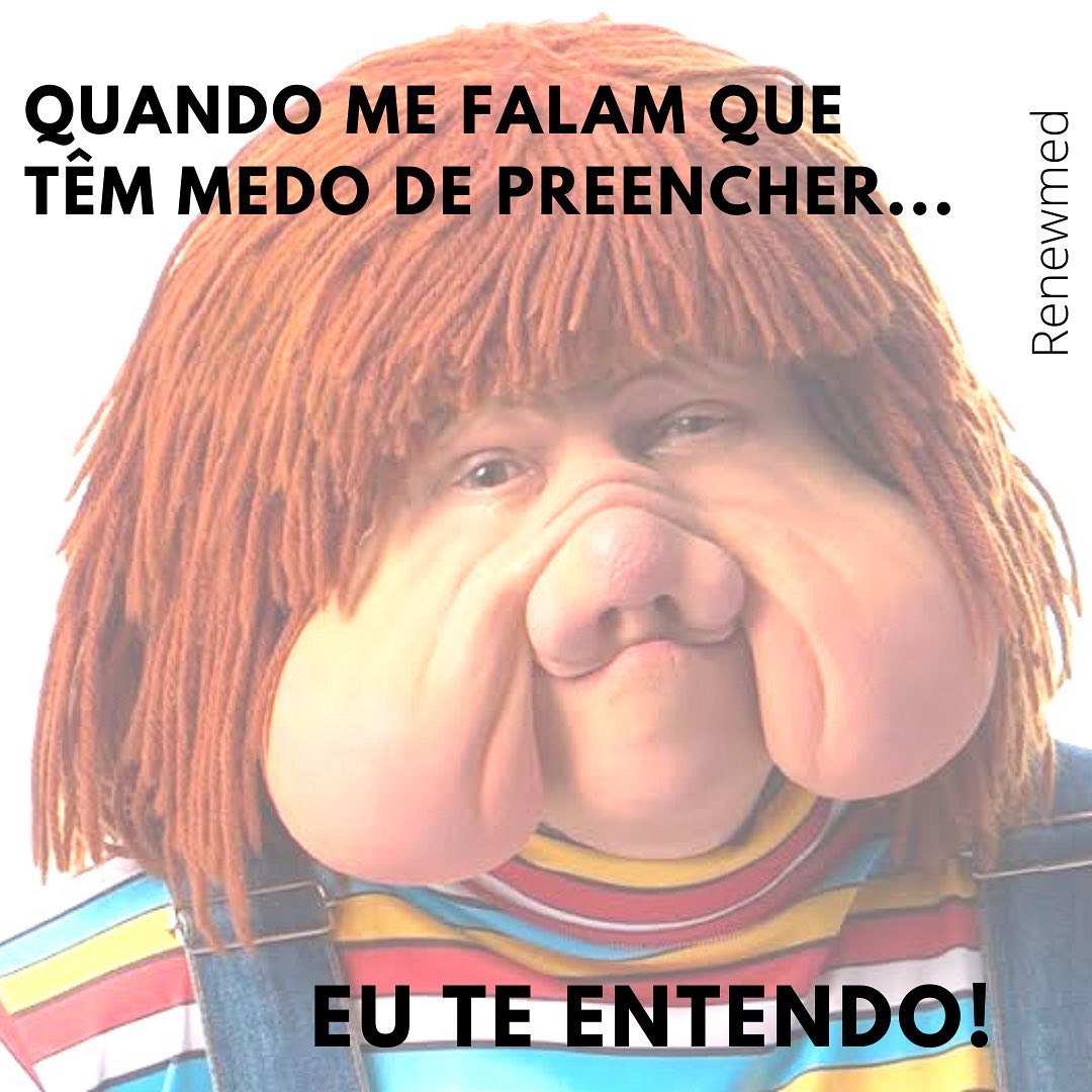 Se você já viu alguém parecendo o fofão aí na vida real, e morre de medo de preenchimento facial, eu te entendo!!!Mas estou aqui para te dizer que o preenchimento pode ser maravilhoso quando bem executado. Faz um efeito lifting, reposiciona estruturas, alivia as perdas teciduais e traz muita jovialidade!O que não funciona são os excessos. E isso serve para qualquer coisa na vida. Para um melhor resultado estético, durabilidade e como tratamento a longo prazo, o ideal é associar técnicas, e então o preenchimento seria uma das partes desse combo. Assim se evita grandes volumes e os resultados são mais naturais.Outra questão importantíssima, é a técnica de aplicação. Preencher não é só colocar uma massinha na região que afundou ou que tem uma ruga! Existe todo um estudo da face, de anatomia e fisiologia, resposta muscular e dos ligamentos para que a mágica aconteça.Então significa que a maioria dos fofões que a gente vê por aí, são pessoas que preencheram em outros tempos, quando a técnica ainda não era a utilizada hoje, e possivelmente, com outros matérias também! (Embora a gente ainda veja hoje profissionais errando na mão )A notícia boa é que o ácido hialurônico tem antídoto. Uma enzima que o degrada quando aplicada corretamente. Então se não gostou, dá para recomeçar do jeito certo!...#preenchimentofacial #preenchimentolabial #mdcodes #dermatologia #dermato #skincare #harmonizacaofacial #harmonizaçãofacial