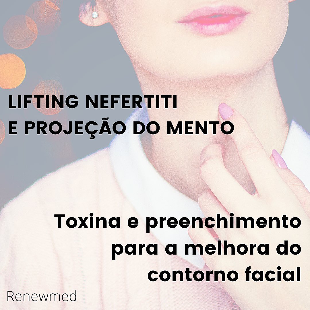 O músculo platisma fica na região do pescoço e contorno da face e em algumas pessoas pode ser visto em duas ou quatro linhas longitudinais de maior força na frente e laterais do pescoço.O fato é que ao longo de toda a vida, ele exerce uma força puxando a face para baixo e com o tempo ele também pode ser responsável pela perda do contorno facial juntamente com o depressor do ângulo oral que está presente ali nos cantinhos da boca.Não é uma indicação absoluta para todas as pessoas, mas muitas podem se beneficiar da aplicação de botox em pontos estratégicos do platisma para recuperarem o desenho harmonioso do contorno da face e fazer um alongamento e lifting da região.Associado a isso, muitas pessoas se beneficiam de um preenchimento do queixo, para alongar ainda mais o contorno.Essa não é uma queixa tão comum dos pacientes, pois nos vemos de frente no espelho. Mas nas fotos de perfil, ou numa avaliação mais detalhada pelo médico, podemos saber quando um pouquinho mais de projeção pode ajudar!O resultado é incrível, e vale a pena testar!