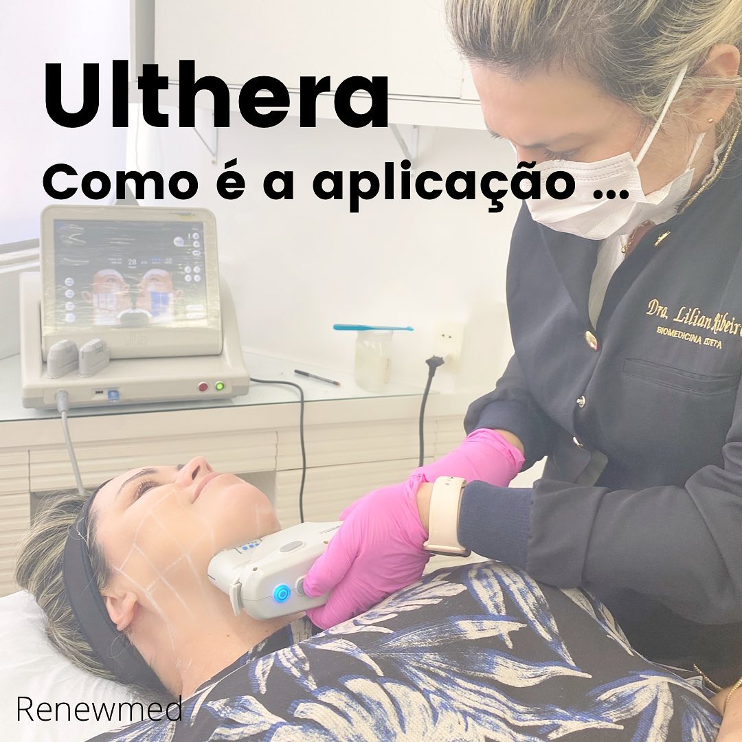 Hoje fiz uma sessão do Ulthera pela primeira vez. Já faz tempo que eu queria experimentar, mas confesso que faltava um pouco de coragem...Que os efeitos eram maravilhosos eu não duvidava, pois já acompanhei diversas pacientes com resultados belíssimos... Mas e a dor????Para minha surpresa (e olha que eu sou meio mole para isso) achei que sim, de fato o anestésico ajuda a dar conta de praticamente todo o procedimento. No início não senti nadinha, porém no final, com os tecidos já sensibilizados, senti dor sim! Tive que pedir para ir mais devagar, mas nem sequer cogitei em diminuir a energia. Foi suportável, e ao acabar a dor foi como num passe de mágica... era de fato só para aguentar os últimos disparos!É importante fazer o protocolo completo. Não dá para querermos chegar no resultado ideal fazendo menos disparos do que o recomendado.Esse tipo de economia aqui não funciona! E assim eu fiz, e não me arrependo!Os resultados vem em até 3 meses, justamente no meu aniversário, mas eu já dei os parabéns para essa belezinha que me afinou o rosto e levantou os cantinhos da boca imediatamente!Vem colágeno!!!!#ulthera #ultheralift #ultrassommicrofocado