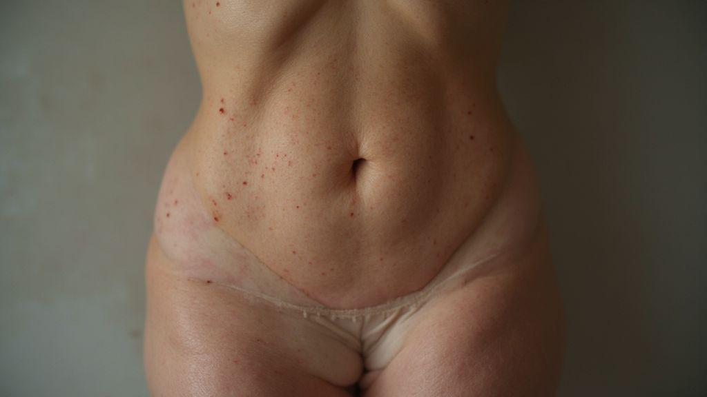 como-tratar-flacidez-abdominal-depois-da-gravidez